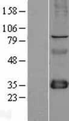 Western Blot FHL1 Overexpression Lysate