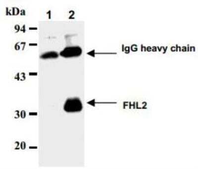 Immunoprecipitation: FHL2 Antibody (11-134) [NBP1-54577] - Immunoprecipitation of FHL2 from C2C12 cells with normal mouse IgG (1) or NBP1-54577 (2). After immunoprecipitated with the antibody, immunocomplex was resolved on SDS-PAGE.