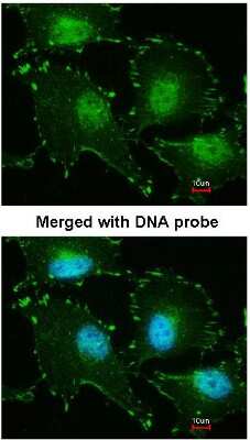 Immunocytochemistry/Immunofluorescence: FHL2 Antibody [NBP1-31262] - Analysis of HeLa, using FHL2 antibody at 1:200 dilution.