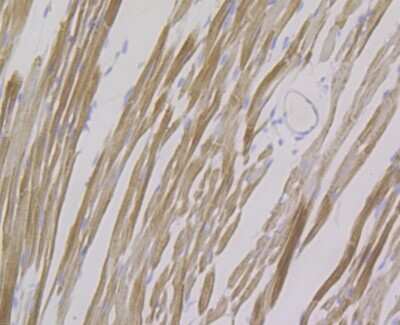 Immunohistochemistry-Paraffin: FHL2 Antibody (JG36-42) [NBP2-75489] - Analysis of paraffin-embedded mouse heart tissue using anti-FHL2 antibody. Counter stained with hematoxylin.
