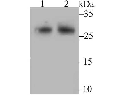 Western Blot: FHL2 Antibody (JG36-42) [NBP2-75489] - Analysis of FHL2 on different tissue lysates using anti-FHL2 antibody at 1/1,000 dilution.Positive control:Lane 1: Rat heart    Lane 2: Mouse heart