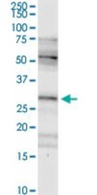 Western Blot: FHL2 Antibody [H00002274-D01P] - Analysis of FHL2 expression in human pancreas.