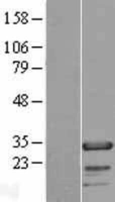 Western Blot: FHL2 Overexpression Lysate (Adult Normal) [NBP2-08208] Left-Empty vector transfected control cell lysate (HEK293 cell lysate); Right -Over-expression Lysate for FHL2.