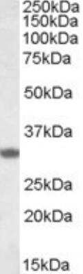 Western Blot: FHL3 Antibody [NBP1-26395] - (1ug/ml) Western blot analysis of Human Skeletal Muscle lysate (35ug protein in RIPA buffer) using NBP1-26395 at 1ug/ml. Primary incubation was 1 hour. Detected by chemiluminescence.