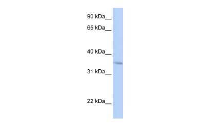 Western Blot: FHL3 Antibody [NBP2-87440] - WB Suggested Anti-FHL3 Antibody Titration: 0.2-1 ug/ml. Positive Control: HepG2 cell lysate