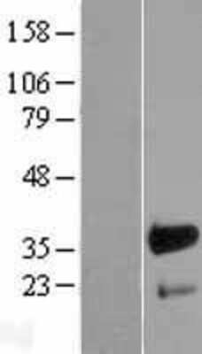 Western Blot: FHL3 Overexpression Lysate (Adult Normal) [NBL1-10716] Left-Empty vector transfected control cell lysate (HEK293 cell lysate); Right -Over-expression Lysate for FHL3.