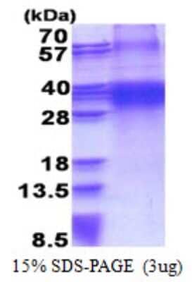 SDS-Page: FHL3 Protein [NBP2-23057]