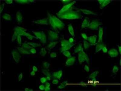 Immunocytochemistry/Immunofluorescence: FHL5 Antibody (1G12-D2) [H00009457-M01] - Analysis of monoclonal antibody to FHL5 on HepG2 cell. Antibody concentration 10 ug/ml.