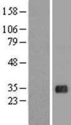 Western Blot: FHL5 Overexpression Lysate (Adult Normal) [NBL1-10717] Left-Empty vector transfected control cell lysate (HEK293 cell lysate); Right -Over-expression Lysate for FHL5.