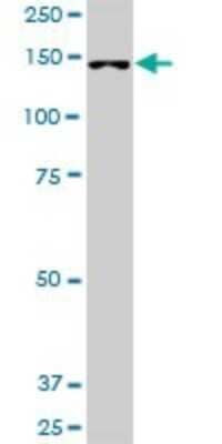 Western Blot: FHOD1 Antibody [H00029109-B01P] - Analysis of FHOD1 expression in HepG2.