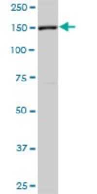 Western Blot: FHOD1 Antibody [H00029109-B01P] - Analysis of FHOD1 expression in K-562.