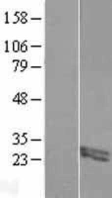 Western Blot FIBIN Overexpression Lysate