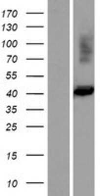 Western Blot: FIBP Overexpression Lysate (Adult Normal) [NBP2-04674] Left-Empty vector transfected control cell lysate (HEK293 cell lysate); Right -Over-expression Lysate for FIBP.
