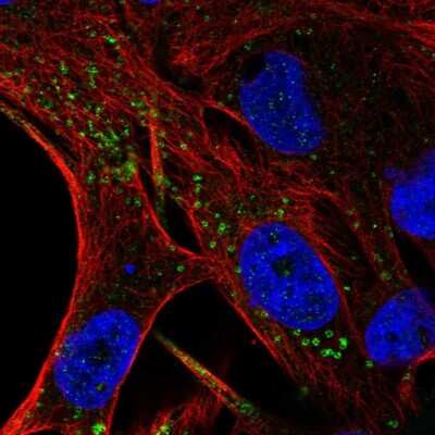 Immunocytochemistry/Immunofluorescence: FIG4 Antibody [NBP2-56977] - Staining of human cell line SK-MEL-30 shows localization to vesicles & lipid droplets. Antibody staining is shown in green.
