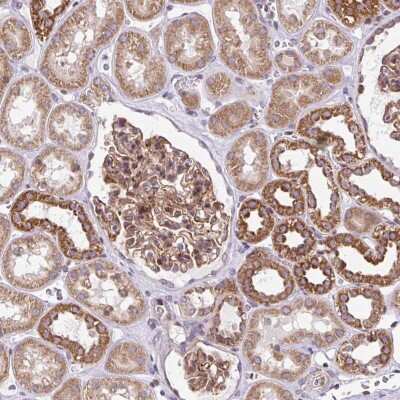 Immunohistochemistry-Paraffin: FIGNL1 Antibody [NBP2-47456] - Staining of human kidney shows moderate granular cytoplasmic positivity in cells in tubules.