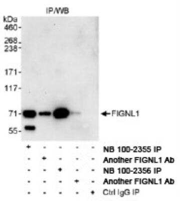 Immunoprecipitation: FIGNL1 Antibody [NB100-2356] - Detection of Human FIGNL1 by Western Blot of  Immunoprecipitates. Samples: Whole cell lysate (1 mg for IP,  20% of IP loaded) from HeLa cells.  Antibodies:  Affinity purified  rabbit anti-FIGNL1 antibody NB100-2356  used for IP at 3 mcg/mg lysate. FIGNL1 was also  immunoprecipitated by other rabbit anti-FIGNL1 antibodies and NB100-2355.  Detection:  Chemiluminescence with an  exposure time of 30 seconds.