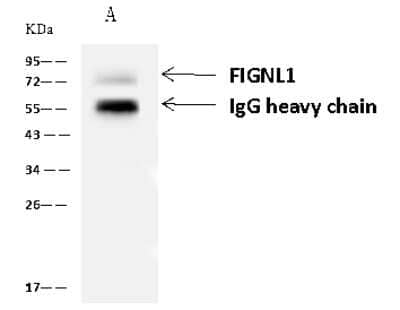 Immunoprecipitation: FIGNL1 Antibody [NBP2-97167] - FIGNL1 was immunoprecipitated using: Lane A: 0.5 mg HeLa Whole Cell Lysate 4 ul anti-FIGNL1 rabbit polyclonal antibody and 60 ug of Immunomagnetic beads Protein A/G.  Primary antibody: Anti-FIGNL1 rabbit polyclonal antibody, at 1:100 dilution. Secondary antibody: Goat Anti-Rabbit IgG (H+L)/HRP at 1/10000 dilution. Developed using the ECL technique. Performed under reducing conditions. Predicted band size: 74 kDa. Observed band size: 72 kDa