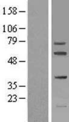 Western Blot: FIGNL1 Overexpression Lysate (Adult Normal) [NBL1-10724] Left-Empty vector transfected control cell lysate (HEK293 cell lysate); Right -Over-expression Lysate for FIGNL1.