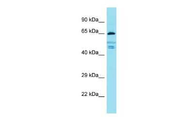 Western Blot: FIGNL2 Antibody [NBP3-09720] - Western blot analysis of FIGNL2 in 721_B Whole Cell lysates. Antibody dilution at 1.0ug/ml