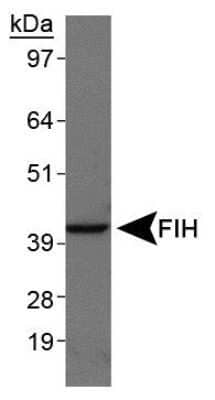 Western Blot: FIH-1/HIF-1AN Antibody (162c) - Azide and BSA Free [NBP2-80738] - Analysis in A431 cell lysates using NBP1-30333. Image from the standard format of this antibody.