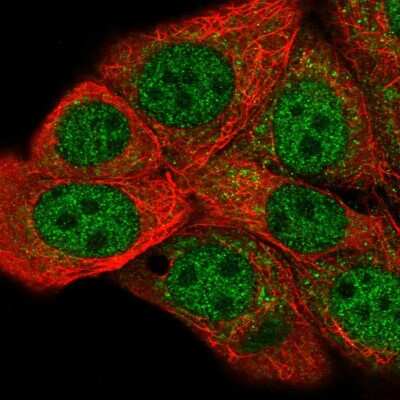 Immunocytochemistry/Immunofluorescence: FIH-1/HIF-1AN Antibody [NBP2-58365] - Staining of human cell line MCF7 shows localization to nucleoplasm & cytosol.