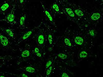 Immunocytochemistry/Immunofluorescence: FIH-1/HIF-1AN Antibody [NBP2-98999] - Immunofluorescence staining of FIH-1/HIF-1AN in HeLa cells. Cells were fixed with 4% PFA, blocked with 10% serum, and incubated with rabbit anti-human FIH-1/HIF-1AN polyclonal antibody (1:1000) at 4C overnight. Then cells were stained with the Alexa Fluor(R)488-conjugated Goat Anti-rabbit IgG Secondary antibody (green).Positive staining was localized to nucleus.