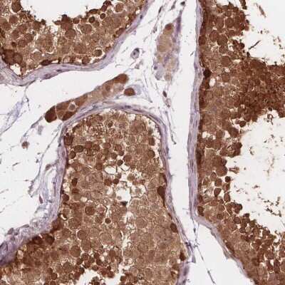 Immunohistochemistry-Paraffin: FIH-1/HIF-1AN Antibody [NBP2-54749] - Staining of human testis shows strong nuclear and cytoplasmic positivity in seminiferous ducts.