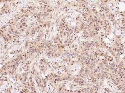 Immunohistochemistry-Paraffin: FIH-1/HIF-1AN Antibody [NBP2-99356] - Immunochemical staining of human FIH-1/HIF-1AN in human kidney with rabbit polyclonal antibody at 1:300 dilution, formalin-fixed paraffin embedded sections.