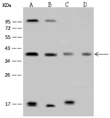 Western Blot: FIH-1/HIF-1AN Antibody [NBP2-99356] - Anti-FIH-1/HIF-1AN rabbit polyclonal antibody at 1:500 dilution. Lane A: Jurkat Whole Cell Lysate Lane B: MCF7 Whole Cell Lysate Lane C: K562 Whole Cell Lysate Lane D: A431 Whole Cell Lysate Lysates/proteins at 30 ug per lane. Secondary Goat Anti-Rabbit IgG (H+L)/HRP at 1/10000 dilution. Developed using the ECL technique. Performed under reducing conditions. Predicted band size: 40 kDa. Observed band size: 40 kDa