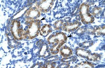 Immunohistochemistry-Paraffin: FIZ1 Antibody [NBP2-82793] - Rabbit Anti-FLJ14768 Antibody. Paraffin Embedded Tissue: Human Kidney. Cellular Data: Epithelial cells of renal tubule. Antibody Concentration: 4.0-8.0 ug/ml. Magnification: 400X