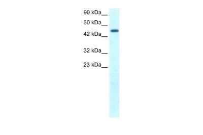 Western Blot: FIZ1 Antibody [NBP2-82793] - WB Suggested Anti-FLJ14768 Antibody Titration: 1.25ug/ml. ELISA Titer: 1:62500. Positive Control: Human Kidney