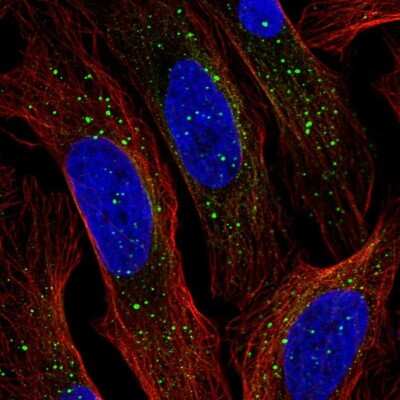 Immunocytochemistry/Immunofluorescence: FJX1 Antibody [NBP2-32442] - Staining of human cell line U-2 OS shows localization to vesicles. Antibody staining is shown in green.