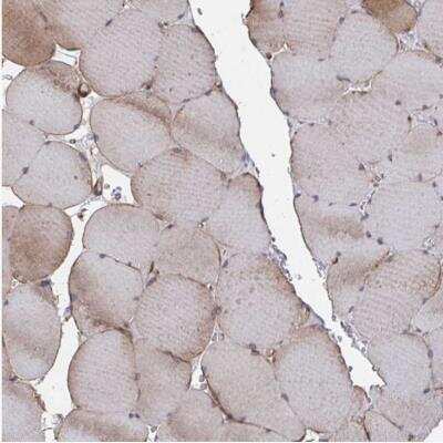 Immunohistochemistry-Paraffin: FJX1 Antibody [NBP2-32442] - Staining of human skeletal muscle shows no positivity in myocytes.