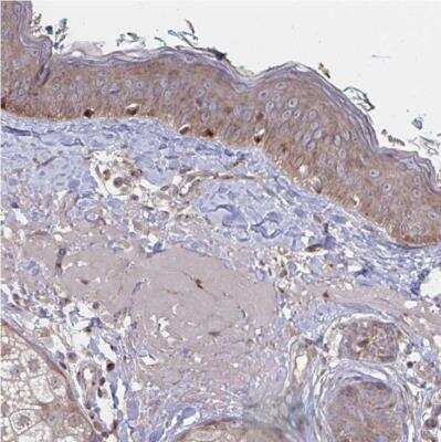 Immunohistochemistry-Paraffin: FJX1 Antibody [NBP2-32442] - Staining of human skin shows strong cytoplasmic positivity in keratinocytes.