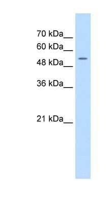 Western Blot: FJX1 Antibody [NBP1-59470] - Jurkat cell lysate, concentration 0.2-1 ug/ml.