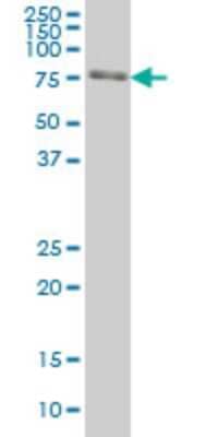 Western Blot: FKBP10 Antibody (1C6) [H00060681-M01] - FKBP10 monoclonal antibody (M01), clone 1C6 Analysis of FKBP10 expression in HeLa.