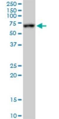 Western Blot: FKBP10 Antibody (3B5) [H00060681-M02] - FKBP10 monoclonal antibody (M02), clone 3B5. Analysis of FKBP10 expression in HepG2.