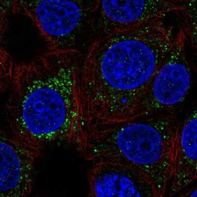 Immunocytochemistry/Immunofluorescence: FKBP10 Antibody [NBP2-14016] - Immunofluorescent staining of human cell line MCF7 shows localization to vesicles.