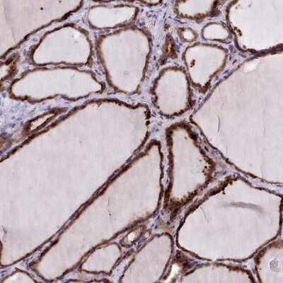 Immunohistochemistry-Paraffin: FKBP10 Antibody [NBP2-14016] - Staining of human thyroid gland shows strong cytoplasmic positivity in glandular cells.