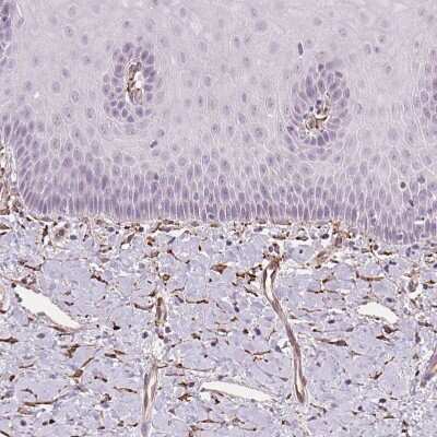 Immunohistochemistry-Paraffin: FKBP10 Antibody [NBP2-49242] - Staining of human uterine cervix shows strong cytoplasmic positivity in fibroblasts.