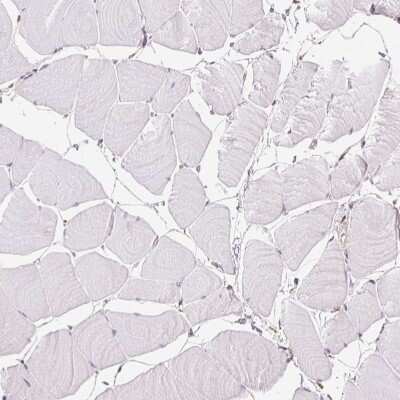 Immunohistochemistry-Paraffin: FKBP10 Antibody [NBP2-49242] - Staining of human skeletal muscle shows no positivity in myocytes as expected.