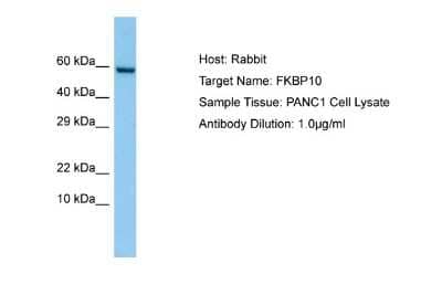 Western Blot: FKBP10 Antibody [NBP1-98560] - Antibody Dilution: 1.0ug/ml Sample Tissue: PANC1 cell lysate.