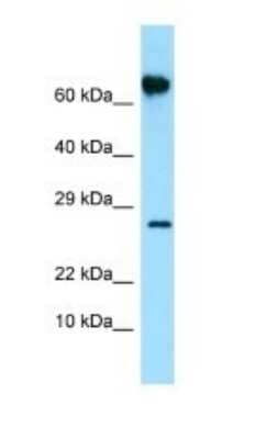 Western Blot: FKBP10 Antibody [NBP1-98561] - Titration: 1.0 ug/ml Positive Control: Placenta.