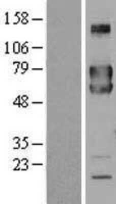 Western Blot: FKBP10 Overexpression Lysate (Adult Normal) [NBL1-10729] Left-Empty vector transfected control cell lysate (HEK293 cell lysate); Right -Over-expression Lysate for FKBP10.