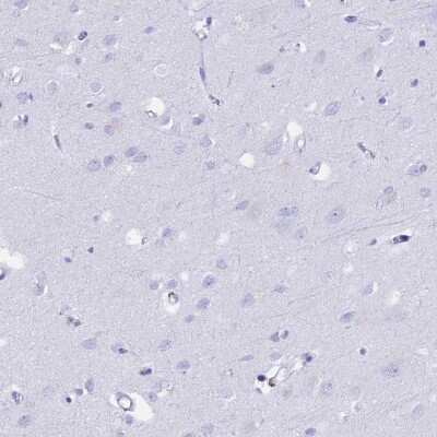 Immunohistochemistry-Paraffin FKBP11 Antibody