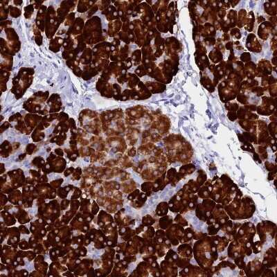 Immunohistochemistry-Paraffin FKBP11 Antibody