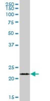 Western Blot: FKBP11 Antibody [H00051303-B01P] - Analysis of FKBP11 expression in human pancreas.