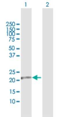 Western Blot: FKBP11 Antibody [H00051303-D01P] - Analysis of FKBP11 expression in transfected 293T cell line by FKBP11 polyclonal antibody.Lane 1: FKBP11 transfected lysate(22.20 KDa).Lane 2: Non-transfected lysate.