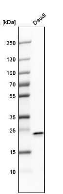 Western Blot: FKBP11 Antibody [NBP1-84678] - Analysis in human cell line Daudi.