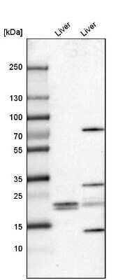 Western Blot FKBP11 Antibody